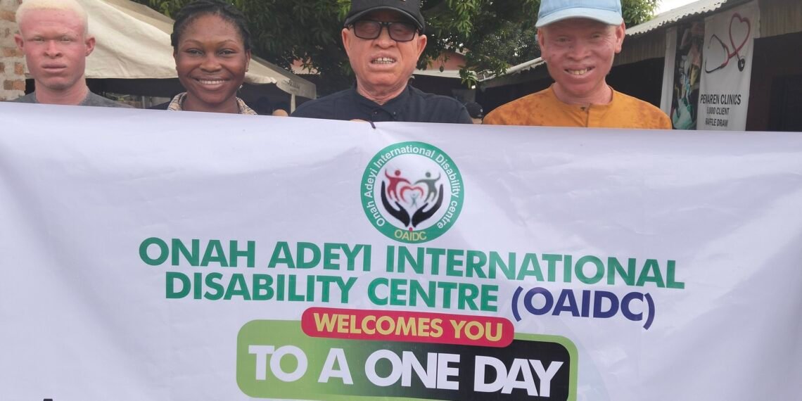 Persons with Albinism holding an event flex banner along with Mr Onah