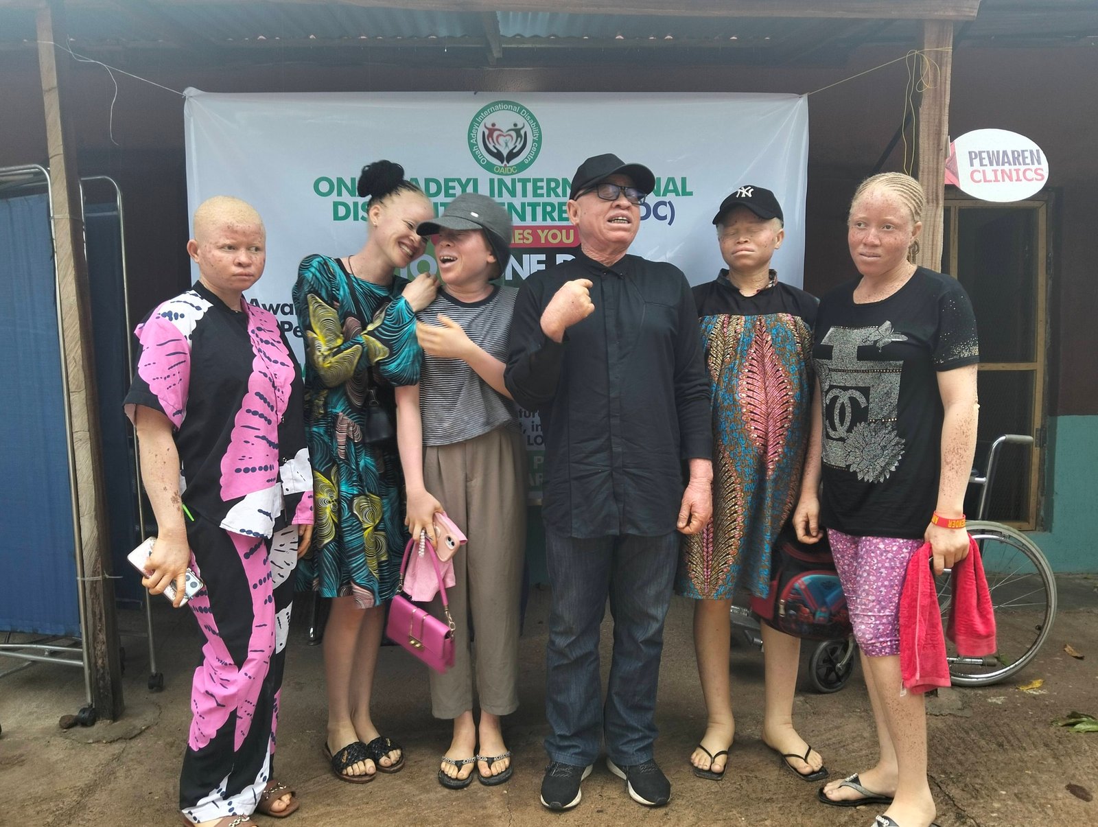 Picture of Mr Onah with females with Albinism a the Sentization & Awareness Event