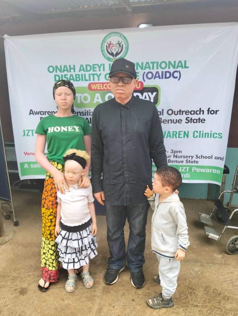 Picture of Mr Onah with other persons with Albinism a the Sensitization & Awareness Event